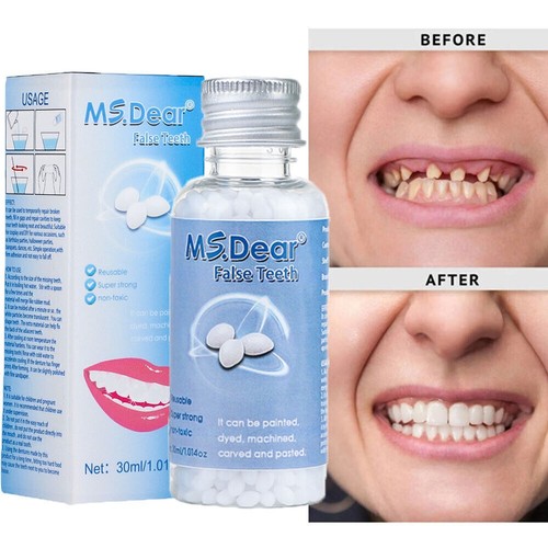 Kit fake teeth permanent - teeth,