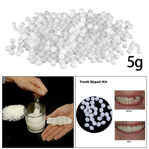 Teeth repair kit permanent - kit,